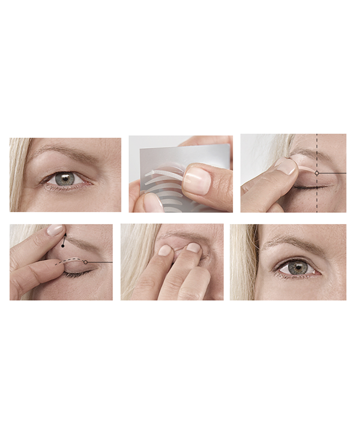 תהליך שימוש במדבקות העיניים להרמת העפעף העליון בשלבים עם אישה מדגימה
